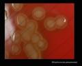 streptococcus pneumoniae type of hemolysis